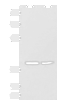 Western blot analysis of Hela and 231 cell lysates  using HPDL Polyclonal Antibody at dilution of 1:400