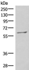 Western blot analysis of RAW264.7 cell lysate  using MBTPS2 Polyclonal Antibody at dilution of 1:800