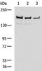 Western blot analysis of Mouse brain tissue Rat brain tissue and HepG2 cell lysates  using ROCK2 Polyclonal Antibody at dilution of 1:400