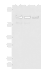 Western blot analysis of Mouse brain tissue Rat brain tissue and HepG2 cell lysates  using ROCK2 Polyclonal Antibody at dilution of 1:400