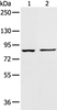Western blot analysis of 293T cell and Human left kidney tissue  using AAK1 Polyclonal Antibody at dilution of 1:400