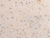 Immunohistochemistry of paraffin-embedded Human brain tissue  using PPM1D Polyclonal Antibody at dilution of 1:60(×200)