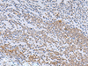 Immunohistochemistry of paraffin-embedded Human tonsil tissue  using IL22RA2 Polyclonal Antibody at dilution of 1:70(×200)