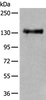 Western blot analysis of Mouse brain tissue lysate  using PTPRA Polyclonal Antibody at dilution of 1:400