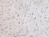 Immunohistochemistry of paraffin-embedded Human brain tissue  using RAB4A Polyclonal Antibody at dilution of 1:40(×200)