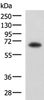 Western blot analysis of PC3 cell lysate  using SHC3 Polyclonal Antibody at dilution of 1:650
