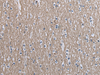 Immunohistochemistry of paraffin-embedded Human brain tissue  using SLC39A14 Polyclonal Antibody at dilution of 1:40(×200)