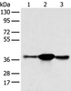 Western blot analysis of K562 A375 and 231 cell  using SPRY4 Polyclonal Antibody at dilution of 1:400