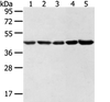 Western blot analysis of Hela lncap NIH/3T3 K562 and 231 cell  using WDR77 Polyclonal Antibody at dilution of 1:500