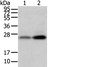 Western blot analysis of Mouse trachea and brain tissue  using WFDC5 Polyclonal Antibody at dilution of 1:1100