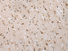Immunohistochemistry of paraffin-embedded Human brain tissue  using HIF1A Polyclonal Antibody at dilution of 1:45(×200)