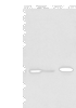 Western blot analysis of HepG2 cell Hela cell and A549 cell  using DHRSX Polyclonal Antibody at dilution of 1:350