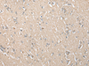 Immunohistochemistry of paraffin-embedded Human brain tissue  using ECI1 Polyclonal Antibody at dilution of 1:30(×200)