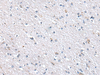 Immunohistochemistry of paraffin-embedded Human brain tissue  using METTL7A Polyclonal Antibody at dilution of 1:40(×200)