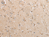 Immunohistochemistry of paraffin-embedded Human brain tissue  using GCLC Polyclonal Antibody at dilution of 1:35(×200)