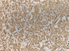 Immunohistochemistry of paraffin-embedded Human tonsil tissue  using ZNF8 Polyclonal Antibody at dilution of 1:40(×200)