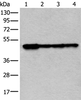 Western blot analysis of 293T and 231 cell lysates  using VRK1 Polyclonal Antibody at dilution of 1:400