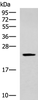 Western blot analysis of Human fetal liver tissue lysate  using CMPK1 Polyclonal Antibody at dilution of 1:700