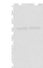 Western blot analysis of Mouse brain tissue and Rat brain tissue lysates  using DDX1 Polyclonal Antibody at dilution of 1:300