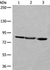 Western blot analysis of A549 Jurkat and HEPG2 cell lysates  using TAGAP Polyclonal Antibody at dilution of 1:400