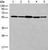 Western blot analysis of 293T cell HUVEC cell Hela cell lysates  using RAD23B Polyclonal Antibody at dilution of 1:350