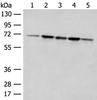 Western blot analysis of 293T cell Rat liver tissue A172 and Jurkat cell lysates  using ACSF2 Polyclonal Antibody at dilution of 1:400