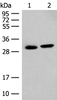 Western blot analysis of Mouse kidney tissue and Human kidney tissue lysates  using GLYAT Polyclonal Antibody at dilution of 1:300