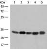 Western blot analysis of 231 PC-3 Hela A375 HepG2 cell lysates  using COPE Polyclonal Antibody at dilution of 1:350