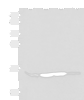 Western blot analysis of HL60 Hela 231 cell Human breast cancer tissue lysates  using RPP14 Polyclonal Antibody at dilution of 1:400