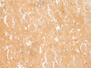 Immunohistochemistry of paraffin-embedded Human brain tissue  using ARPC5L Polyclonal Antibody at dilution of 1:45(×200)