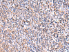 Immunohistochemistry of paraffin-embedded Human tonsil tissue  using UXS1 Polyclonal Antibody at dilution of 1:60(×200)