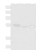 Western blot analysis of Human skin tissue A172 cell Human bladder transitional cell carcinoma grade 2-3 tissue lysates  using IKZF2 Polyclonal Antibody at dilution of 1:950