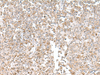 Immunohistochemistry of paraffin-embedded Human tonsil tissue  using EIF1AY Polyclonal Antibody at dilution of 1:55(×200)