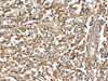 Immunohistochemistry of paraffin-embedded Human tonsil tissue  using RAB23 Polyclonal Antibody at dilution of 1:50(×200)