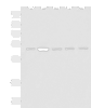 Western blot analysis of 293T LOVO Hela and Jurkat cell lysates  using CHEK2 Polyclonal Antibody at dilution of 1:600