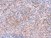 Immunohistochemistry of paraffin-embedded Human tonsil tissue  using NCAN Polyclonal Antibody at dilution of 1:30(×200)