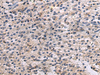 Immunohistochemistry of paraffin-embedded Human brain tissue  using ANGPTL2 Polyclonal Antibody at dilution of 1:55(×200)