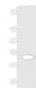 Western blot analysis of Human left kidney paracancerous tissue lysate  using NOTCH4 Polyclonal Antibody at dilution of 1:800