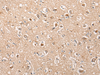 Immunohistochemistry of paraffin-embedded Human brain tissue  using HTRA1  Polyclonal Antibody at dilution of 1:55(×200)