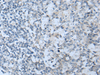 Immunohistochemistry of paraffin-embedded Human tonsil tissue  using STARD4 Polyclonal Antibody at dilution of 1:50(×200)