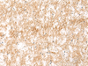 Immunohistochemistry of paraffin-embedded Human brain tissue  using XPC Polyclonal Antibody at dilution of 1:25(×200)
