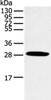 Western blot analysis of Human normal lung tissue  using CLDN25 Polyclonal Antibody at dilution of 1:250