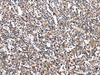 Immunohistochemistry of paraffin-embedded Human tonsil tissue  using HOXB9 Polyclonal Antibody at dilution of 1:45(×200)