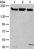 Western blot analysis of Hela 231 and K562 cell lysates  using XRN1 Polyclonal Antibody at dilution of 1:250