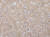 Immunohistochemistry of paraffin-embedded Human brain tissue  using WIF1 Polyclonal Antibody at dilution of 1:100(×200)