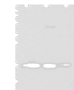 Western blot analysis of Rat brain tissue Human cerebrum tissue Human cerebella tissue lysates  using SNCB Polyclonal Antibody at dilution of 1:450