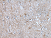 Immunohistochemistry of paraffin-embedded Human brain tissue  using BMP1 Polyclonal Antibody at dilution of 1:105(×200)
