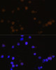 Immunofluorescence analysis of Y79 cells using Rb Polyclonal Antibody at dilution of  1:100 (40x lens). Blue: DAPI for nuclear staining.