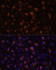 Immunofluorescence analysis of RAW264.7 cells using TLR4 Polyclonal Antibody at dilution of  1:100 (40x lens). Blue: DAPI for nuclear staining.