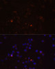Immunofluorescence analysis of THP-1 cells using TLR4 Polyclonal Antibody at dilution of  1:100 (40x lens). Blue: DAPI for nuclear staining.